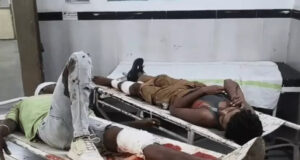 गलत दिशा से आ रहे ट्रैक्टर से टकराई बाइक, आग लगने से जलकर खाक; दो युवक गंभीर घायल